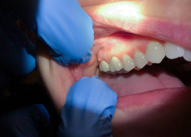 Best Pediatric Emergency Dentist in Colorado City, TX