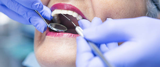 Best Emergency Tooth Extraction in Colorado City, TX